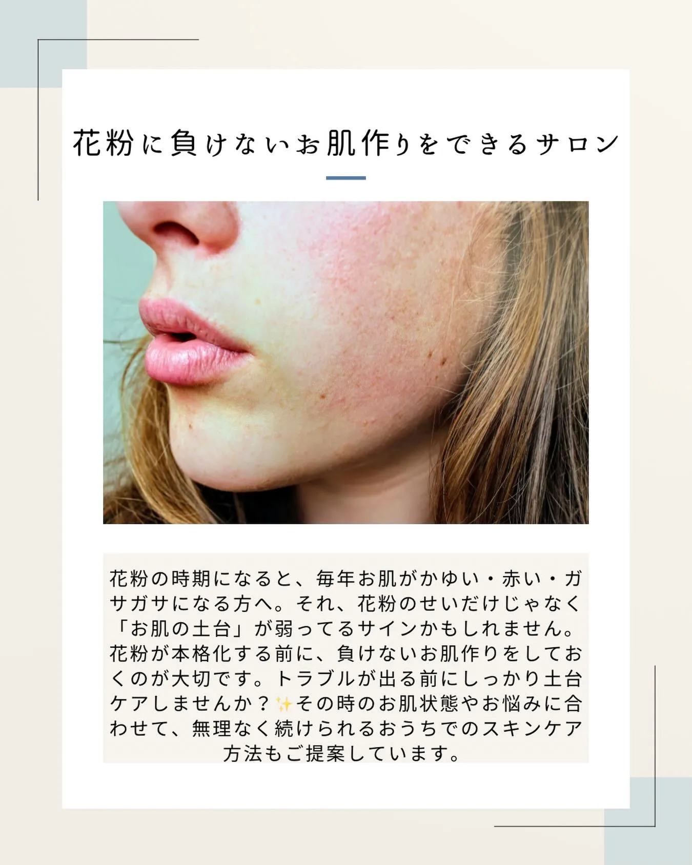 【高石で花粉で肌荒れしてる方】