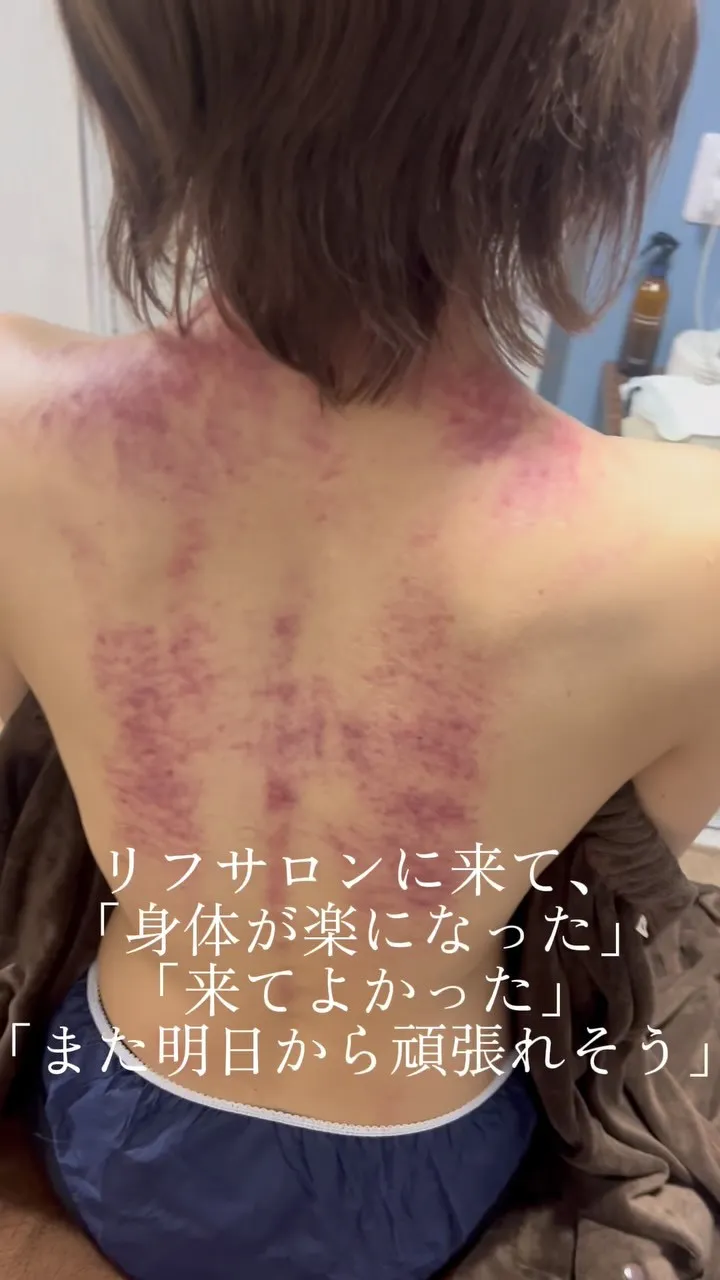 【大阪府高石市で東洋医学のカッサを体験したい方はリフサロン】